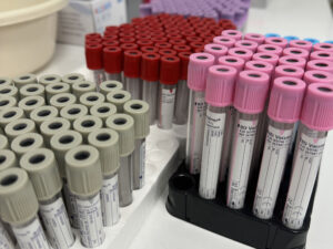 menzurki do pobrań krwi na stole